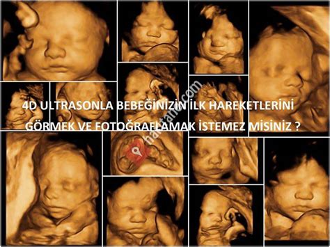 Ankara lina kadın doğum